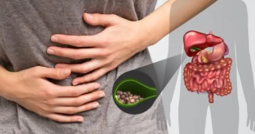 تحذير صحي جديد:  الافراط في تناول السكر يرفع خطر تكون حصوات المرارة