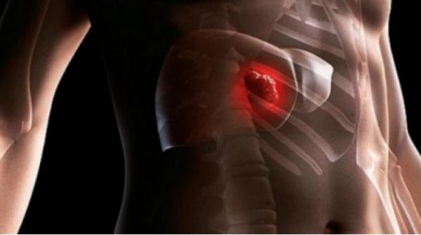 7 علامات تدل على أن كبدك منهك