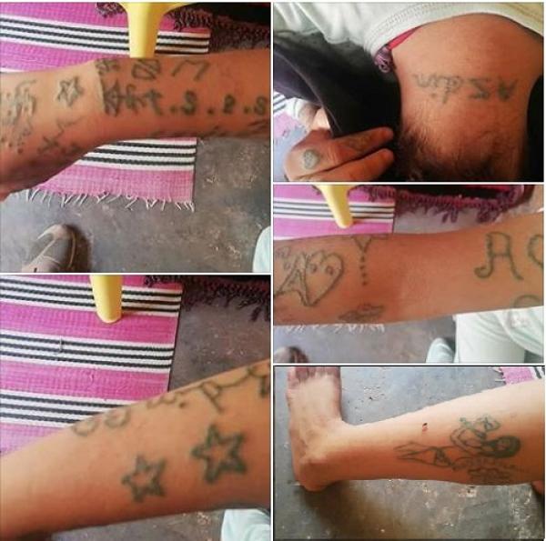 "أخبارنا" تنفرد بنشر معطيات عن الخبرة الطبية لفتاة الوشم "خديجة"