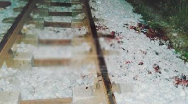 فيتنامية "تستأجر" شاباً يبتر يدها وقدمها للحصول على تأمين