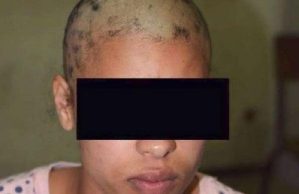 شيماء التي حلقوا شعرها تفجر مفاجأة مدوية خلال جلسة الاستئناف