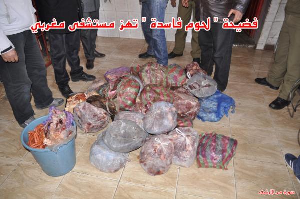 فضيحة : مستشفى عمومي يغذي مرضاه و مستخدميه بـ " لحوم فاسدة " و الإدارة تسعى لطمس الحقائق