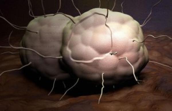 جرثومة السيلان المقاومة للعلاج تزداد انتشارا في العالم