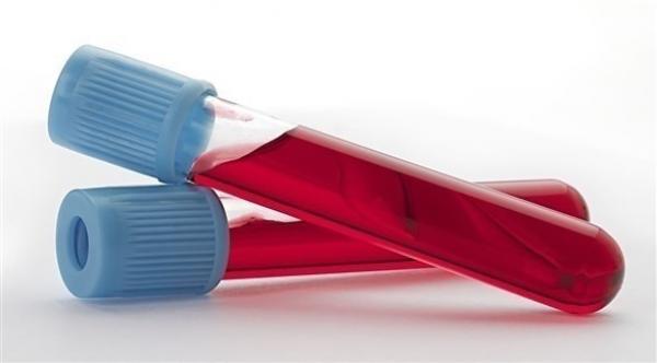 دراسة تكتشف الجانب الإيجابي لزيادة الكولسترول