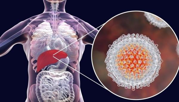 إمكانية جديدة لتطوير لقاح مضاد لالتهاب الكبد الفيروسي سي