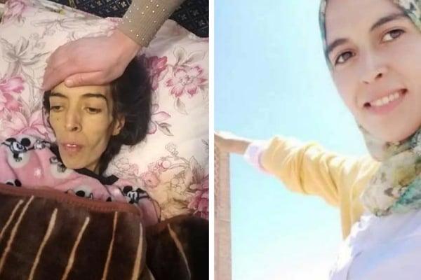 أستاذة حديثة التخرج تعاني في صمت بعد أن أصبحت هيكلا عظميا بسبب السرطان