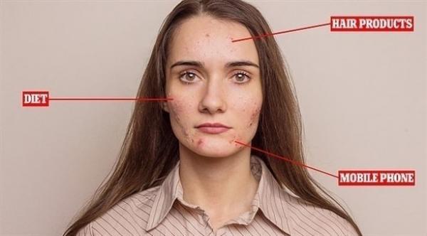 لن تصدق اثر الهواتف الذكية على بشرتك