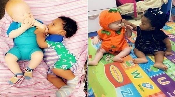 امرأة تنجب طفلين توأم بلونين مختلفين