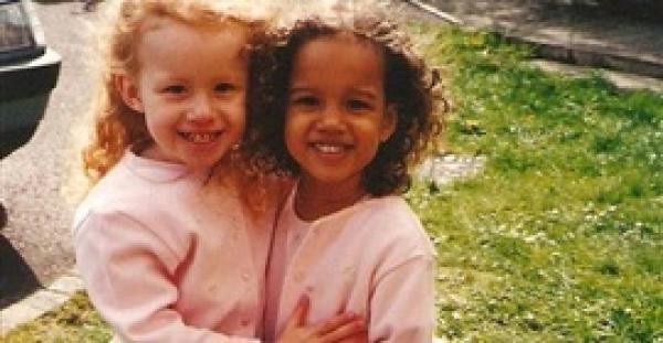 بالفيديو والصور.. أغرب توءم غير متطابق