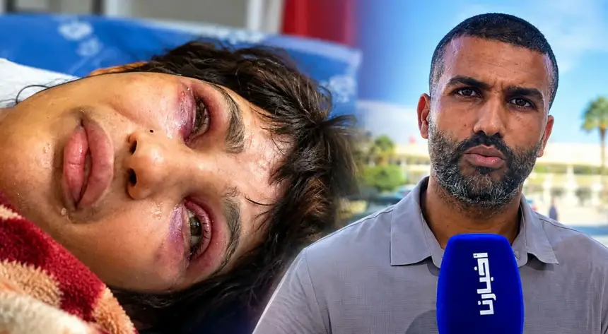 على لسان شقيقها.. قصة الشابة التي أبكت المغاربة وشقيقها يناشد المسؤولين بالوقوف إلى جانبها