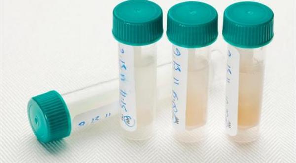 فحص اللعاب يكشف تزايد المخاطر الصحية