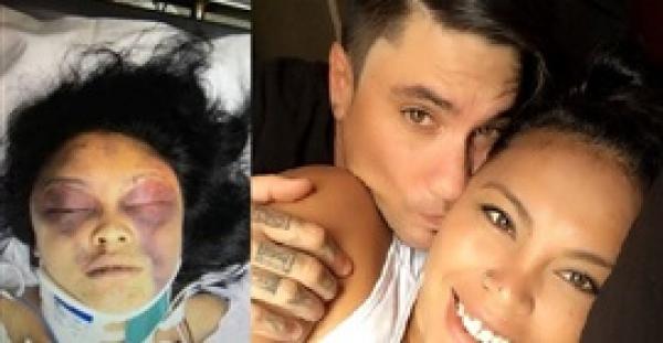 بالصور.. رجل غيور يعتدى على حبيبته بسبب «سيلفى»