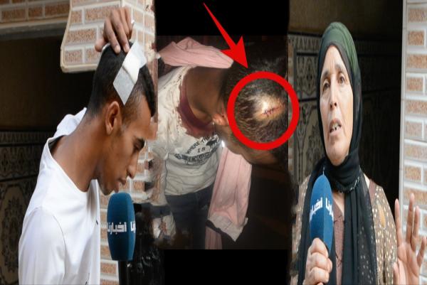 درك الصخيرات يطيح بـ "سمسم" زعيم العصابة المسلحة التي تسببت لشاب في عاهة مستديمة (فيديو)