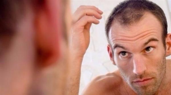 الرجل قصير القامة معرّض للصلع المبكر