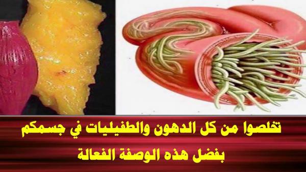 وصفة طبيعية تخلص جسمك من الطفيليات والدهون (فيديو)