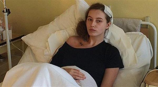 مريضة تستيقظ من التخدير خلال جراحة في الدماغ