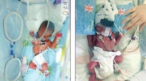 امرأة تنجب مرتين خلال سبعة أيام