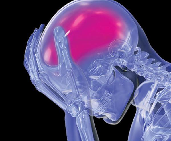 علماء يتوصلون إلى الجين المسؤول عن تقليل السكتات الدماغية