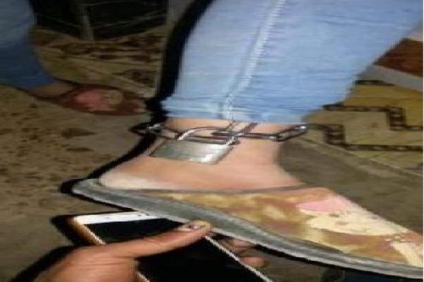 أب مغربي يكبل ابنته بالسلاسل والأقفال والأمن يتدخل (صور)