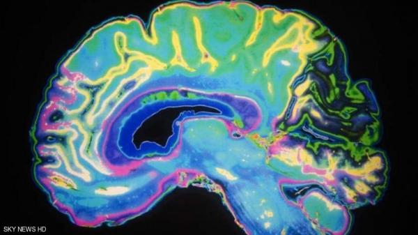 شكل دماغك.. يتحكم بمزاجك