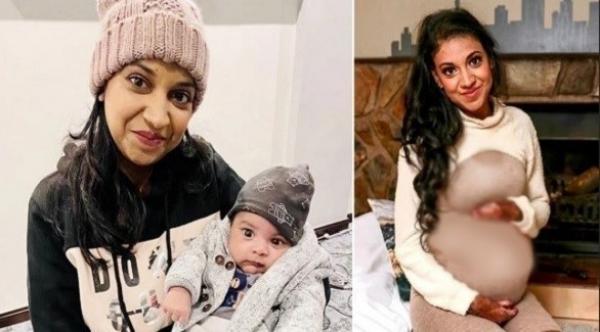 حالة صحية نادرة تسبب لسيدة حروقا شديدة أثناء المخاض