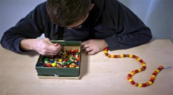 علماء يكتشفون خللاً وراثياً نادراً في الدماغ