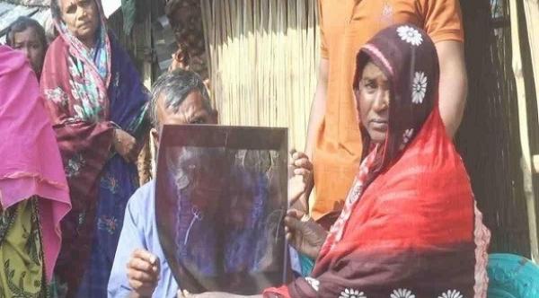 صدمة امرأة اكتشفت وجود مقص جراحي في بطنها لمدة 20 عاماً