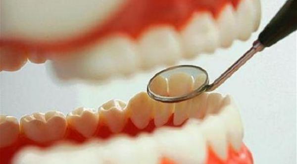 البقع البيضاء علامة على تسوس الأسنان