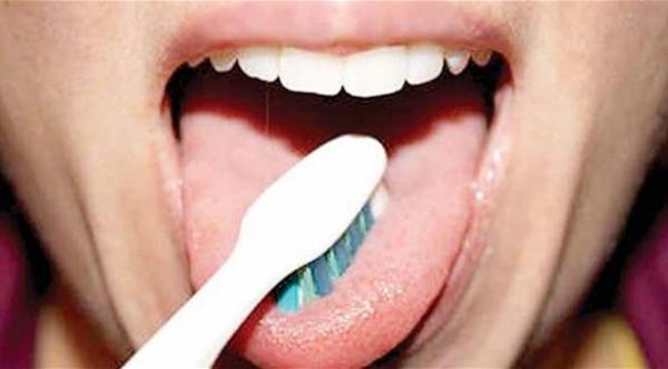 اللسان قد يكون سبب رائحة الفم الكريهة