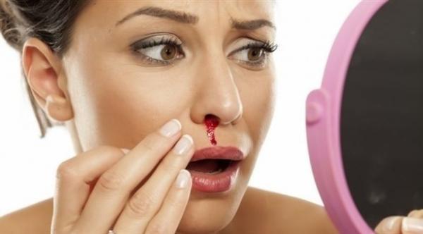 "نزيف الأنف" متى يستوجب استشارة الطبيب؟
