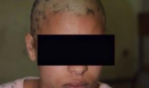 أحكام سجنية صارمة في حق المعتدين على النادلة شيماء و هذه قيمة التعويض المادي الذي ستحصل عليه 