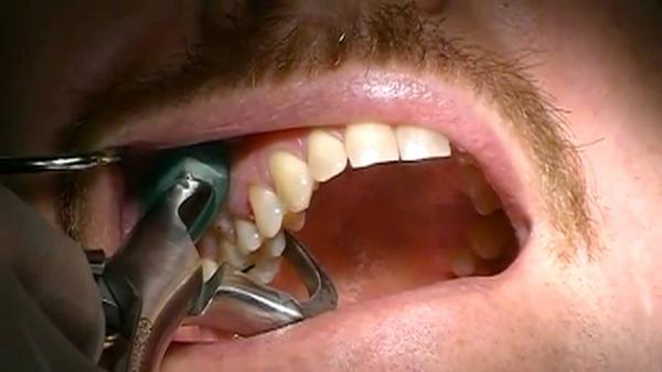 القضاء يصدر حكمه النهائي في حق صانع أسنان تسبب في وفاة طفل بتطوان