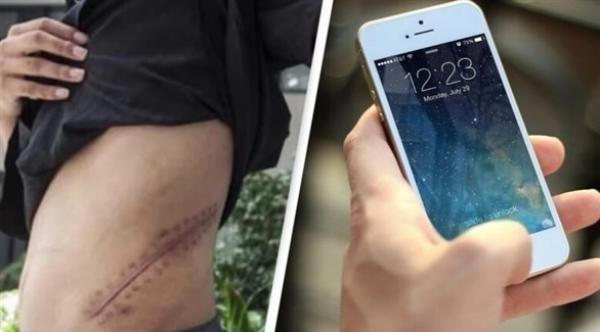 يبيع كليته من أجل شراء آيفون... فيخسر الثانية