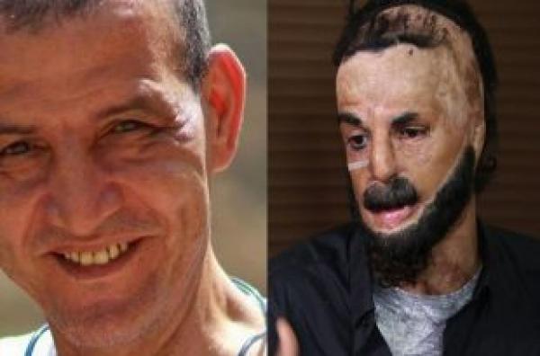 الطبيب العسكري يفضح الطبيب ''حسن بوكيند''