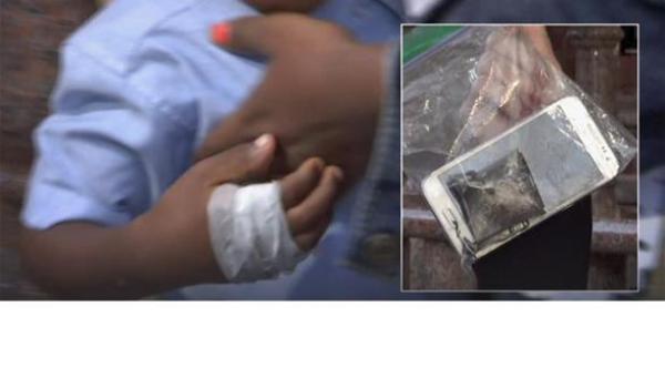 هاتف سامسونغ يحرق يد طفل