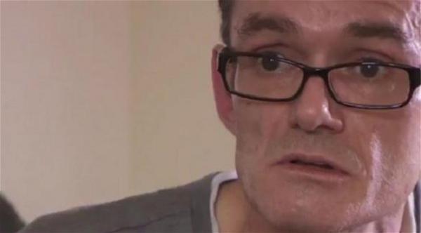 بالفيديو: بريطاني يجري عملية جراحية لنفسه لتصحيح خطأ طبي