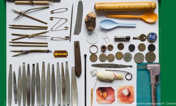 طبيب يستخرج عجائب من جوف سجين عاشق للحرية