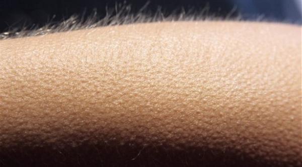 جلد اصطناعي يصاب بالقشعريرة للتعبير عن مشاعر الحزن أو الضيق