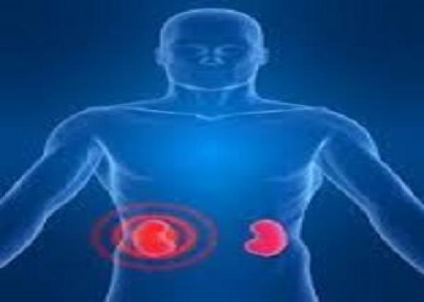 هل يمكن أن تكون مصابا بفشل كلوى دون احساسك !!