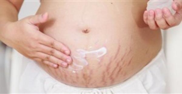 للحوامل.. 4 طرق تخلصك من تشققات البطن نهائيا