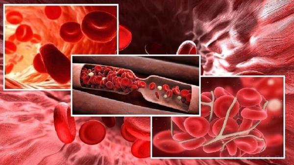 نصيحة طبية: لابد من شرب كمية أكبر من الماء للتقليل من كثافة الدم