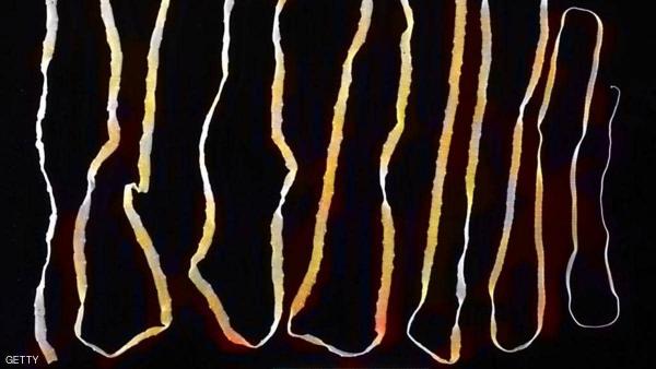 أعراض ومؤشرات تخبرك بعيش الدودة الشريطية داخل جسمك