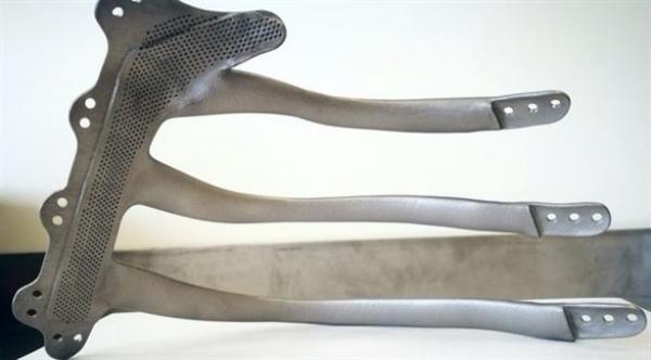 بالفيديو: سبعيني يحصل على أول قفص صدري مطبوع في بريطانيا