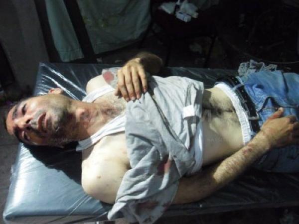 10 قتلى و اكثر من 700 مصاب  إثر هجوم استهدف معتصمي رابعة العدوية