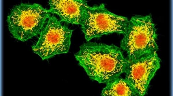 دواء مضاد للاكتئاب يمنع ورم البروستاتا من الانتشار