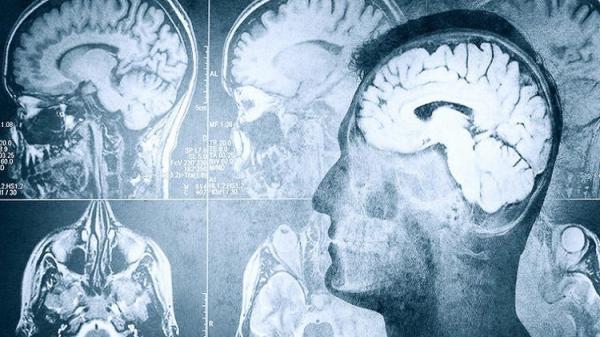 العلماء يؤكدون وجود صلة بين اضطرابات النوم والذاكرة