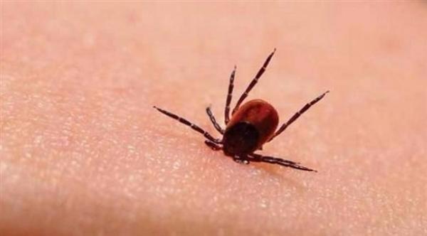 لدغة القراد تهددك بداء لايم