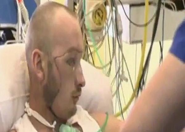 إعجاز طبى.. بالفيديو: أول عملية زراعة وجه في زمن قياسي ببولندا