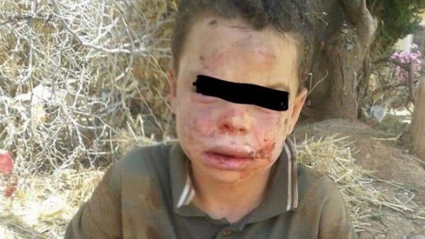 صدمة..القضاء يصدر حكما مخففا في حق أب عذب ابنه وحاول إحراقه داخل فرن