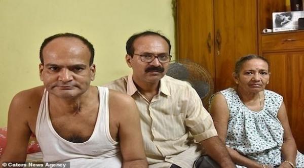 ابتلع أسنانه الاصطناعية فحُرم من الطعام لـ 3 سنوات